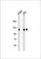 Isoleucyl-TRNA Synthetase 2, Mitochondrial antibody, 63-233, ProSci, Western Blot image 