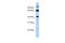 Tripartite Motif Containing 9 antibody, 25-192, ProSci, Western Blot image 