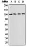 Solute Carrier Family 22 Member 2 antibody, orb214589, Biorbyt, Western Blot image 