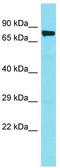 MINDY Lysine 48 Deubiquitinase 4 antibody, TA335431, Origene, Western Blot image 