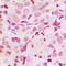 Serum Response Factor antibody, LS-C358337, Lifespan Biosciences, Immunohistochemistry frozen image 