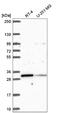 MAX Dimerization Protein MLX antibody, NBP2-55725, Novus Biologicals, Western Blot image 