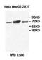 Sec1 family domain-containing protein 1 antibody, orb77875, Biorbyt, Western Blot image 