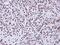 Apoptosis Enhancing Nuclease antibody, NBP1-31700, Novus Biologicals, Immunohistochemistry frozen image 