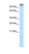 Myocardin Related Transcription Factor A antibody, MBS833630, MyBioSource, Western Blot image 