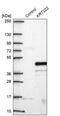 Keratin 222 antibody, PA5-62986, Invitrogen Antibodies, Western Blot image 
