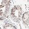 Translin antibody, FNab09048, FineTest, Immunohistochemistry paraffin image 
