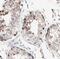 TSN antibody, FNab09048, FineTest, Immunohistochemistry paraffin image 