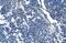 Glucosidase Alpha, Acid antibody, M01548, Boster Biological Technology, Immunohistochemistry frozen image 
