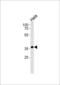 Aldo-Keto Reductase Family 1 Member C3 antibody, LS-C156216, Lifespan Biosciences, Western Blot image 