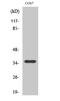 Olfactory Receptor Family 10 Subfamily S Member 1 antibody, A15362, Boster Biological Technology, Western Blot image 