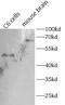 Choline O-Acetyltransferase antibody, FNab10469, FineTest, Western Blot image 