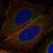 CTD Nuclear Envelope Phosphatase 1 Regulatory Subunit 1 antibody, HPA077906, Atlas Antibodies, Immunofluorescence image 