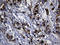 Keratin 14 antibody, LS-C799529, Lifespan Biosciences, Immunohistochemistry paraffin image 