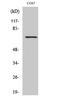 Rac GTPase Activating Protein 1 antibody, A03018, Boster Biological Technology, Western Blot image 