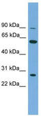 Inosine Monophosphate Dehydrogenase 2 antibody, TA336212, Origene, Western Blot image 