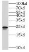 Transmembrane Protein 9 antibody, FNab08792, FineTest, Western Blot image 