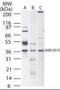 Aldo-Keto Reductase Family 1 Member B10 antibody, orb87898, Biorbyt, Western Blot image 