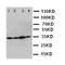 Phosphoinositide-3-Kinase Regulatory Subunit 1 antibody, orb27619, Biorbyt, Western Blot image 