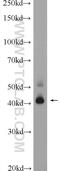 Transmembrane Protein 38B antibody, 19919-1-AP, Proteintech Group, Western Blot image 