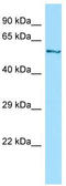 Cytoplasmic dynein 1 light intermediate chain 1 antibody, TA338052, Origene, Western Blot image 