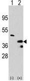 Protein Arginine Methyltransferase 1 antibody, GTX23768, GeneTex, Western Blot image 