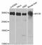 Mechanistic Target Of Rapamycin Kinase antibody, A11354, ABclonal Technology, Western Blot image 