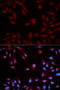 Signal Transducer And Activator Of Transcription 5B antibody, STJ25723, St John