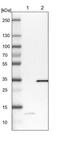 Carbonic Anhydrase 5B antibody, NBP1-86090, Novus Biologicals, Western Blot image 