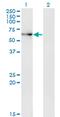 Tripeptidyl Peptidase 1 antibody, MA5-24560, Invitrogen Antibodies, Western Blot image 