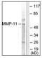 Matrix Metallopeptidase 11 antibody, AP31345PU-N, Origene, Western Blot image 