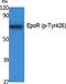 Erythropoietin Receptor antibody, A00427Y426, Boster Biological Technology, Western Blot image 