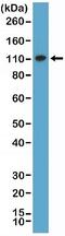 MutS Homolog 2 antibody, NBP2-77433, Novus Biologicals, Western Blot image 