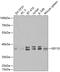 Eukaryotic Translation Elongation Factor 1 Delta antibody, GTX55601, GeneTex, Western Blot image 