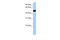 Nuclear Receptor Subfamily 0 Group B Member 1 antibody, 26-270, ProSci, Western Blot image 