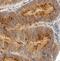 Carbonic Anhydrase 9 antibody, MAB21881, R&D Systems, Immunohistochemistry frozen image 