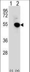 Interferon Regulatory Factor 4 antibody, LS-C165290, Lifespan Biosciences, Western Blot image 