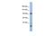 Myosin IC antibody, GTX45070, GeneTex, Western Blot image 