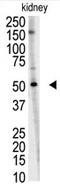 Ring Finger Protein 216 antibody, AP11957PU-N, Origene, Western Blot image 
