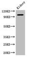 AP2 Associated Kinase 1 antibody, LS-C500941, Lifespan Biosciences, Western Blot image 