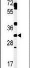 TBC1 Domain Family Member 7 antibody, PA5-26899, Invitrogen Antibodies, Western Blot image 