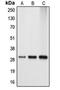 Apolipoprotein A1 antibody, orb215363, Biorbyt, Western Blot image 