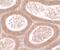 Motile Sperm Domain Containing 1 antibody, PA5-34529, Invitrogen Antibodies, Immunohistochemistry paraffin image 