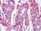 Fyn Related Src Family Tyrosine Kinase antibody, M04075, Boster Biological Technology, Immunohistochemistry paraffin image 