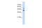 GTP Binding Protein 2 antibody, GTX46997, GeneTex, Western Blot image 