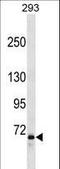 Forkhead Box P2 antibody, LS-C159677, Lifespan Biosciences, Western Blot image 