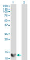 Galectin 1 antibody, LS-C197613, Lifespan Biosciences, Western Blot image 