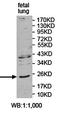 ADP Ribosylation Factor 4 antibody, orb78354, Biorbyt, Western Blot image 