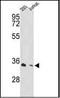 Proteasome 26S Subunit, Non-ATPase 11 antibody, orb96109, Biorbyt, Western Blot image 