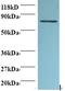 FAS antibody, LS-C211650, Lifespan Biosciences, Western Blot image 
